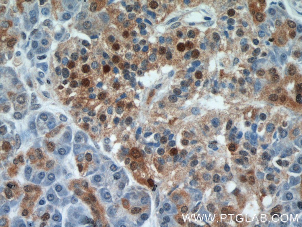 Immunohistochemistry (IHC) staining of human pancreas tissue using ENO1 Polyclonal antibody (55237-1-AP)