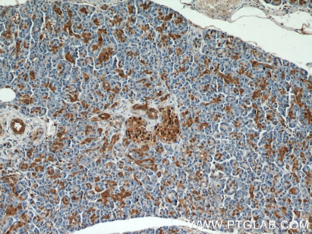 IHC staining of human pancreas using 55237-1-AP