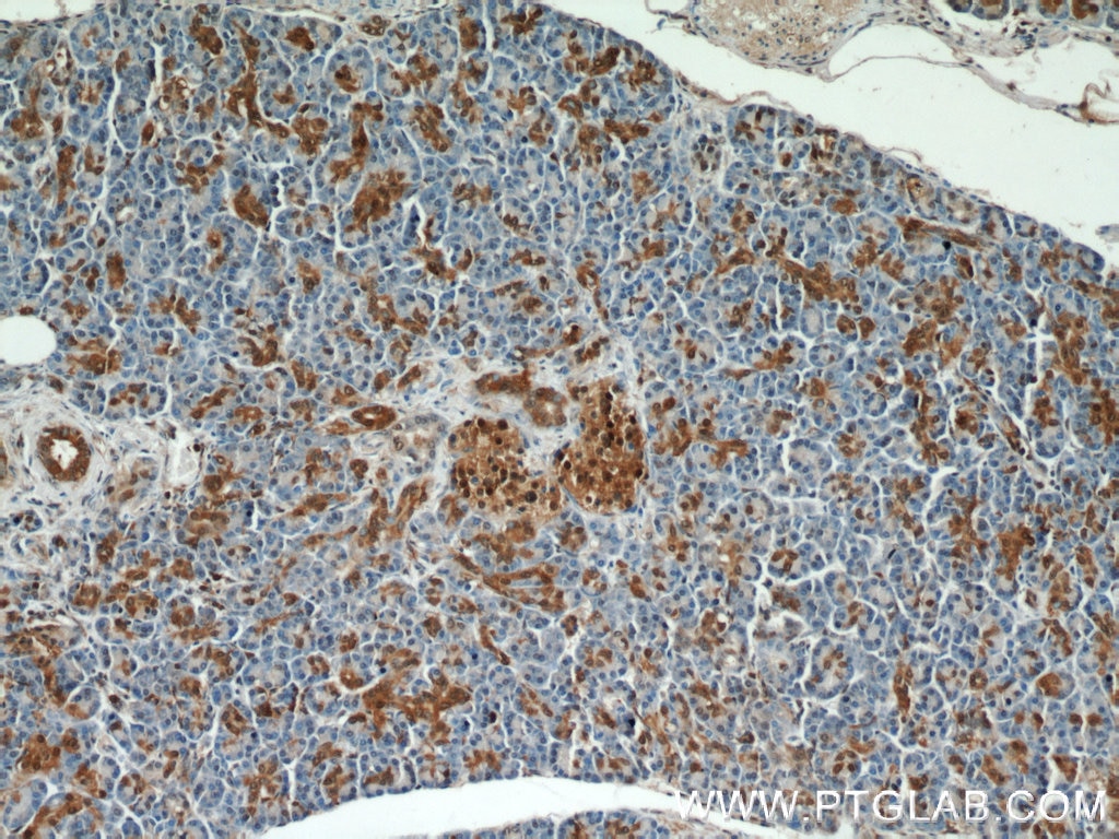 Immunohistochemistry (IHC) staining of human pancreas tissue using ENO1 Polyclonal antibody (55237-1-AP)