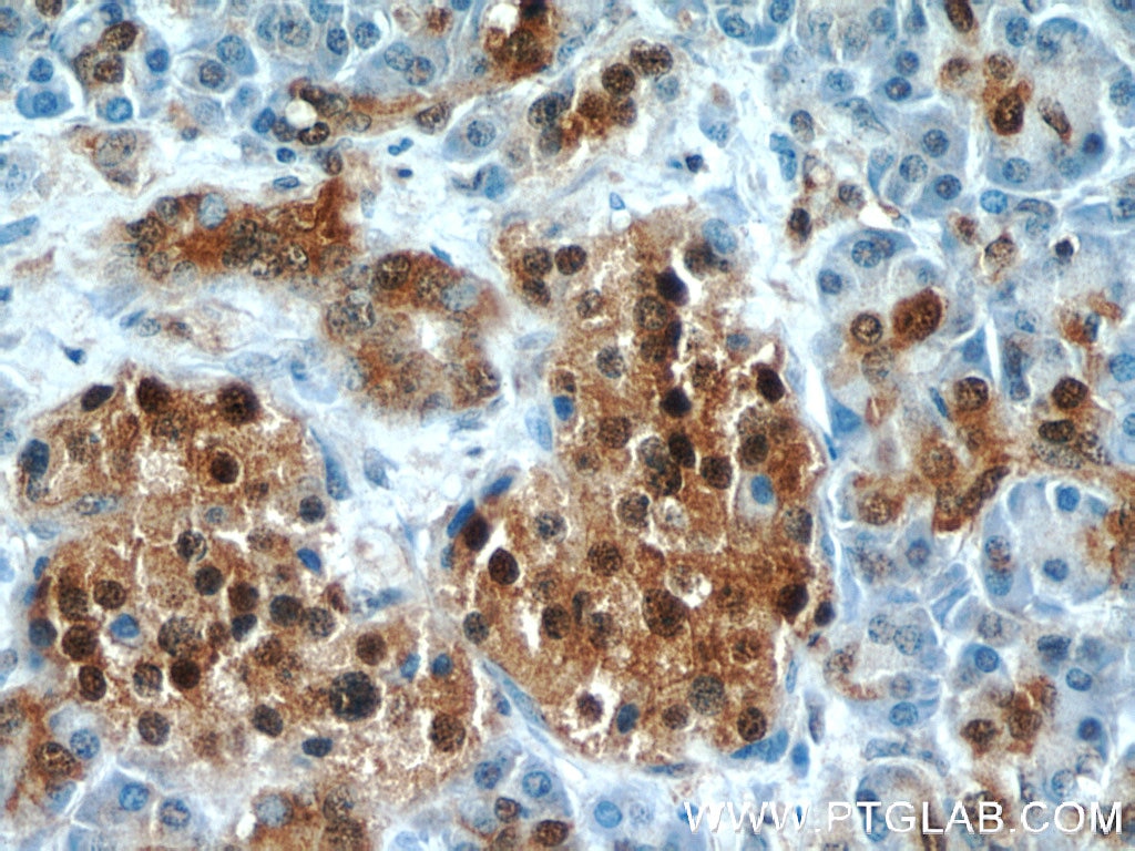 Immunohistochemistry (IHC) staining of human pancreas tissue using ENO1 Polyclonal antibody (55237-1-AP)