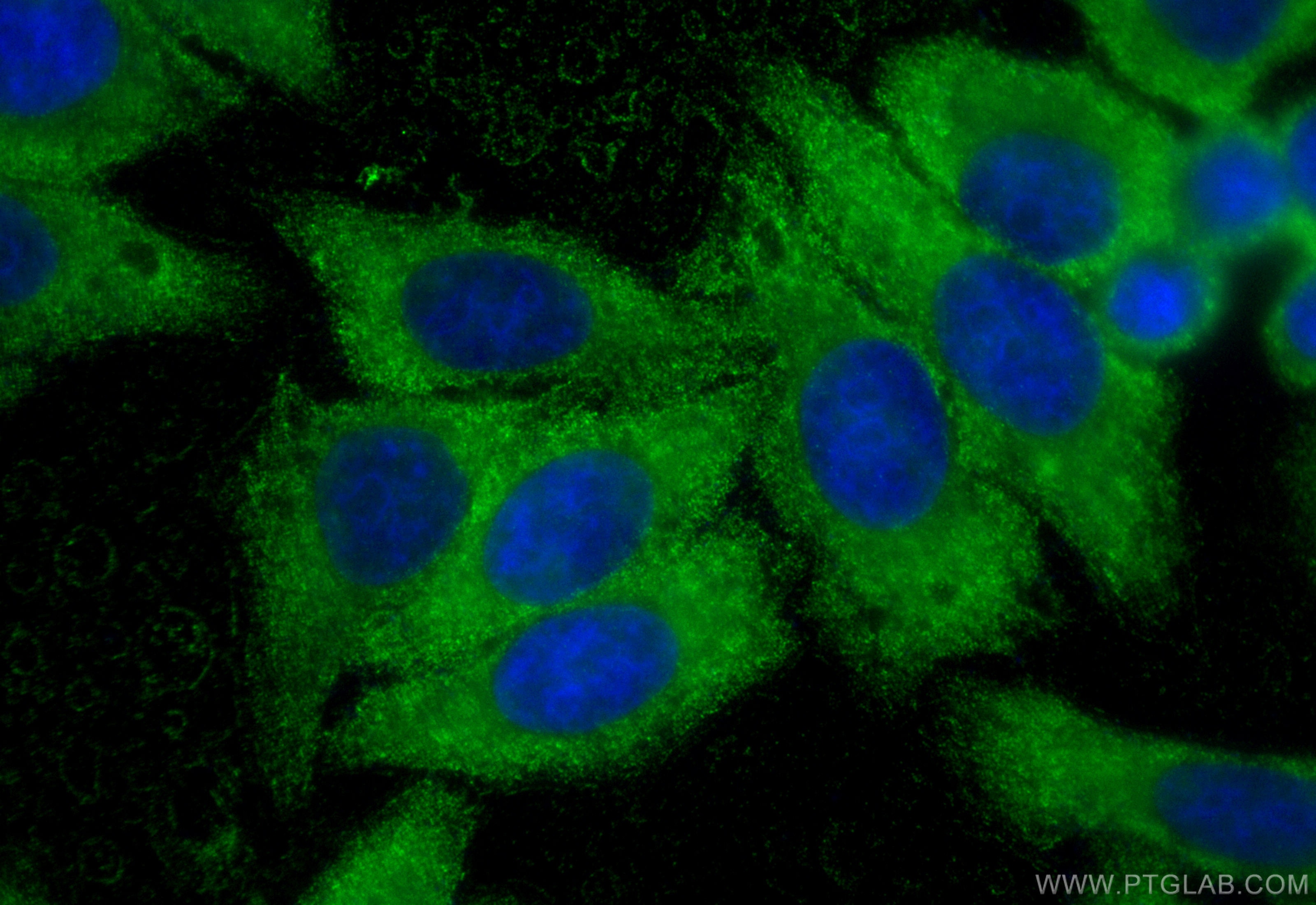 Immunofluorescence (IF) / fluorescent staining of HepG2 cells using ENO1 Monoclonal antibody (67187-1-Ig)