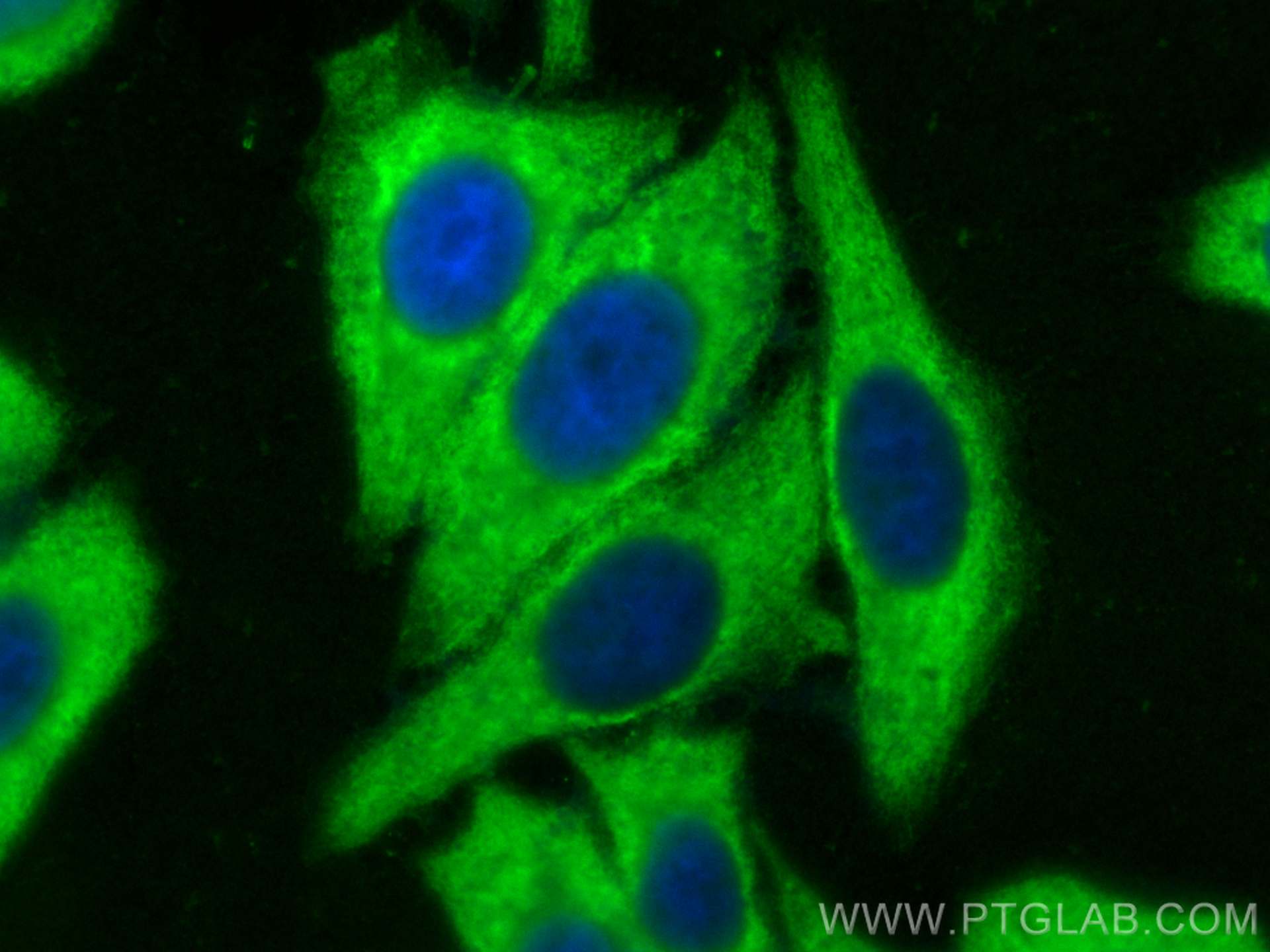 Immunofluorescence (IF) / fluorescent staining of HepG2 cells using ENO1 Recombinant antibody (81478-1-RR)