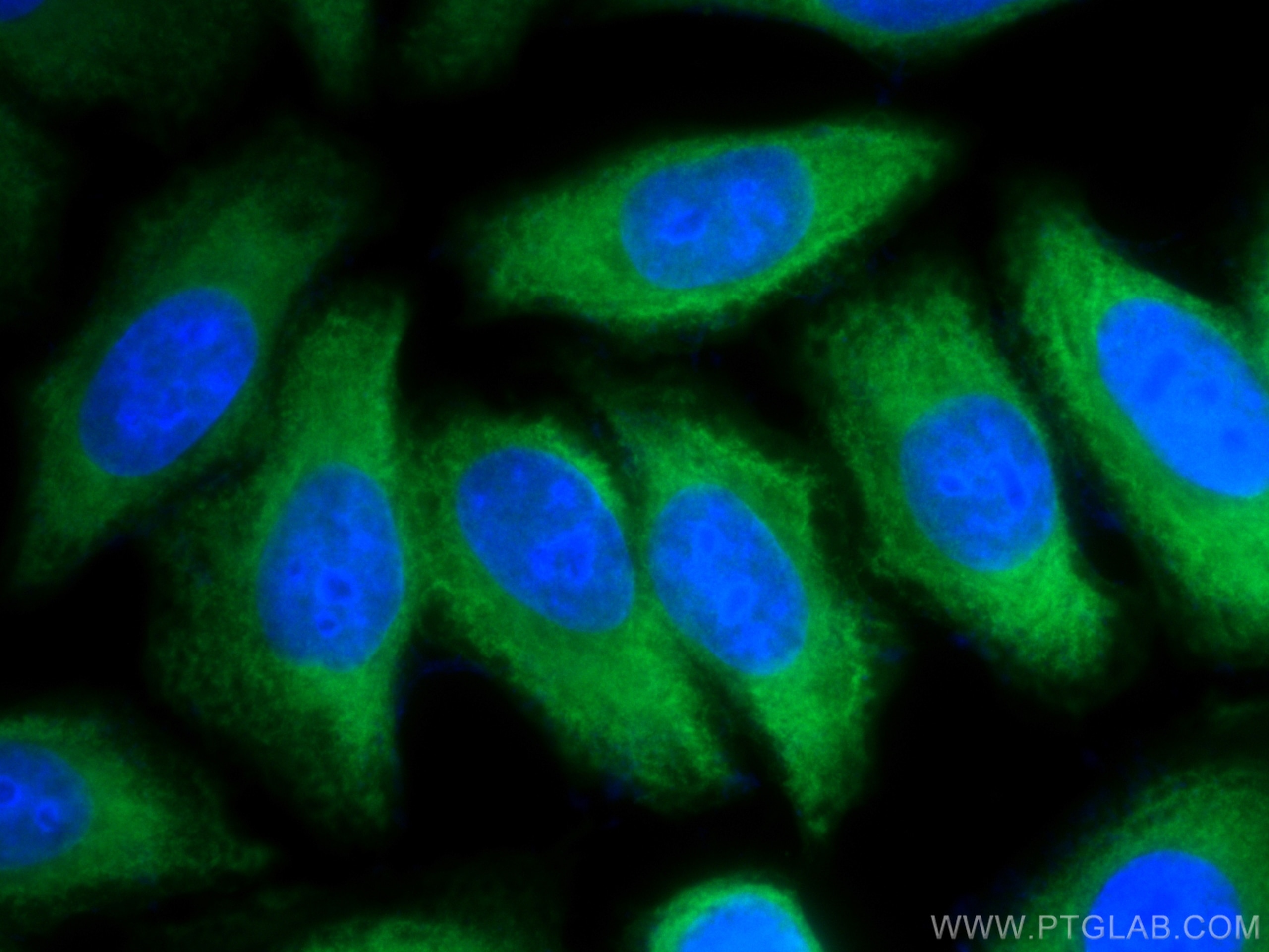 Immunofluorescence (IF) / fluorescent staining of HepG2 cells using CoraLite® Plus 488-conjugated ENO1 Polyclonal anti (CL488-11204)