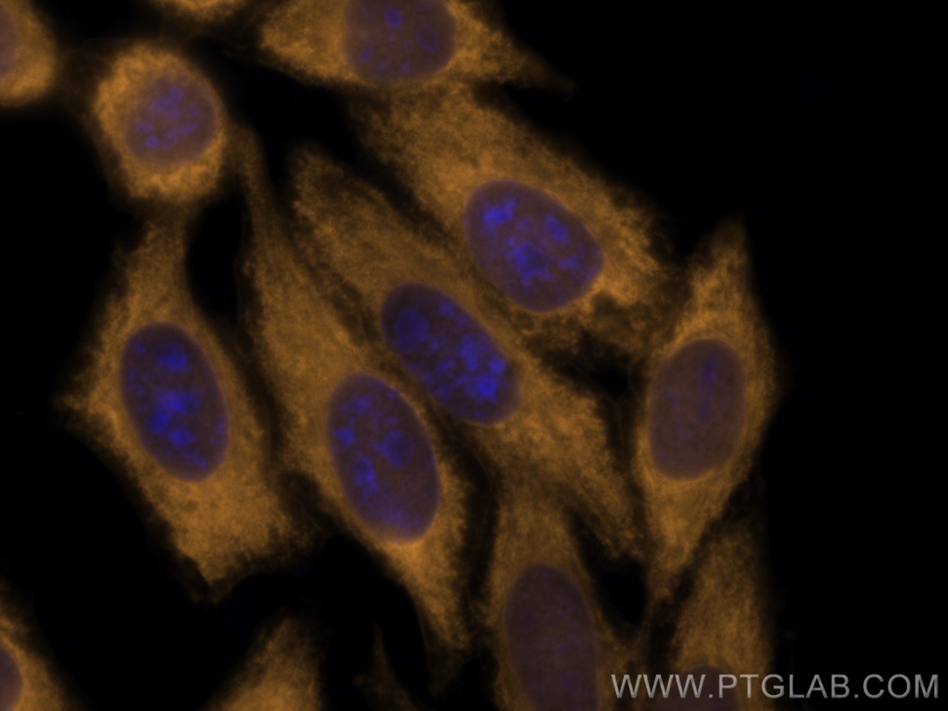 Immunofluorescence (IF) / fluorescent staining of HepG2 cells using CoraLite®555-conjugated ENO1 Polyclonal antibody (CL555-11204)