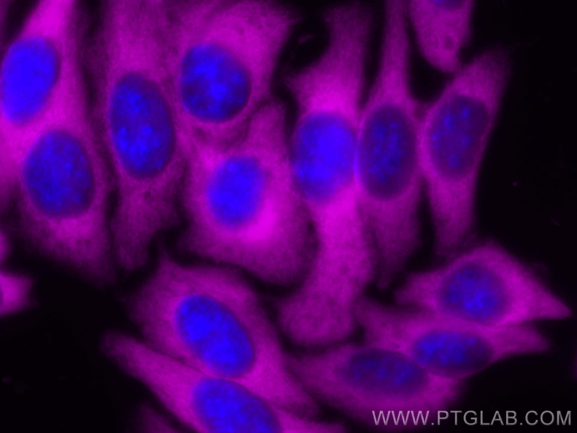 Immunofluorescence (IF) / fluorescent staining of HepG2 cells using CoraLite® Plus 647-conjugated ENO1 Polyclonal anti (CL647-11204)