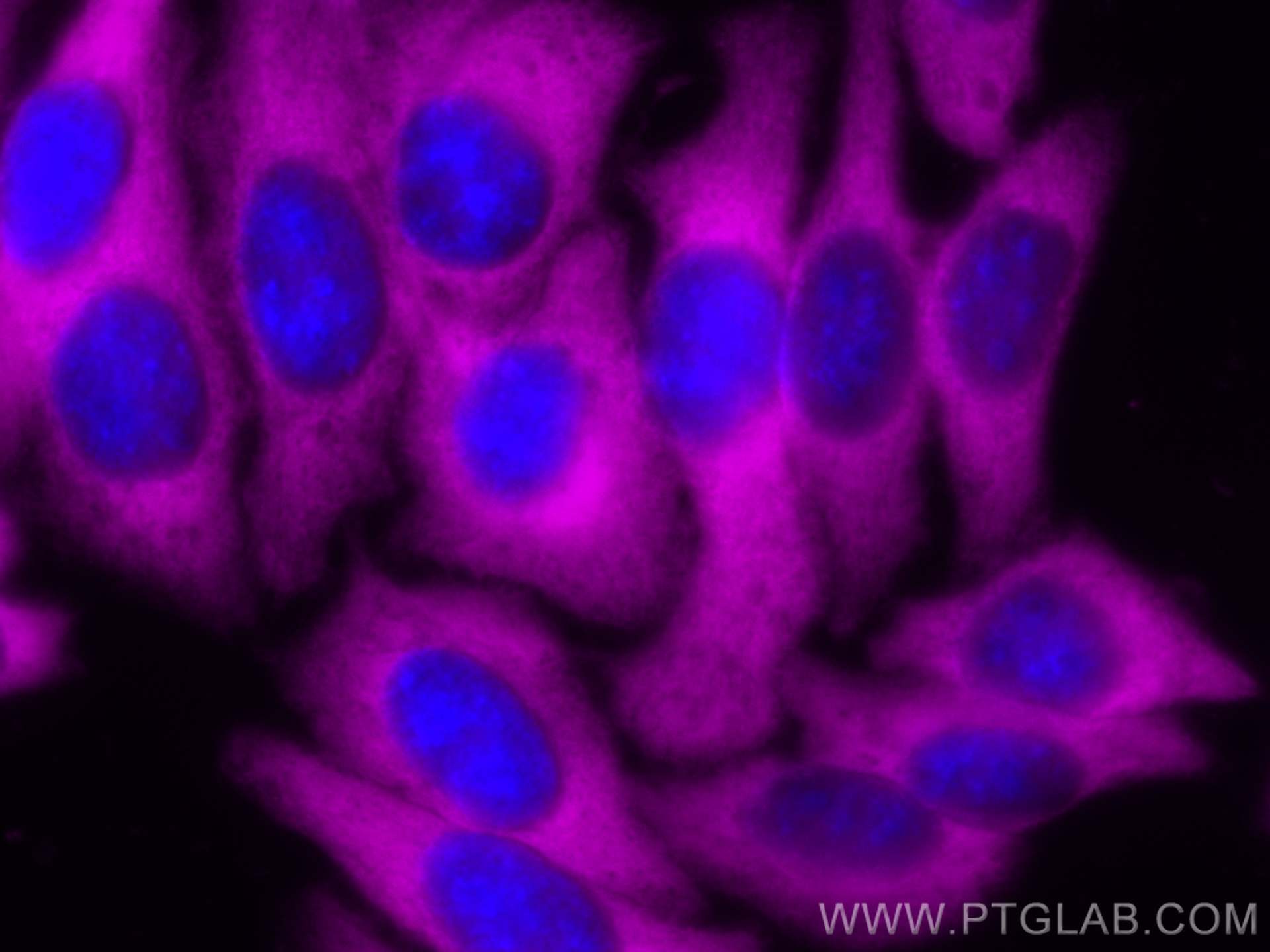 IF Staining of HepG2 using CL647-11204