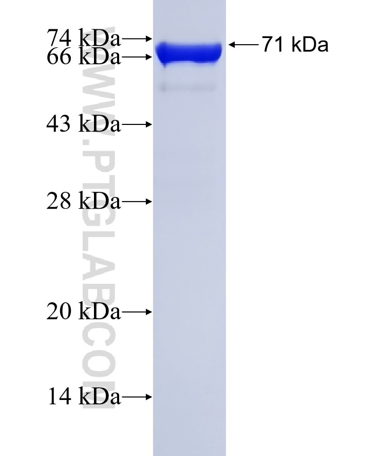 ENO1 fusion protein Ag1692 SDS-PAGE