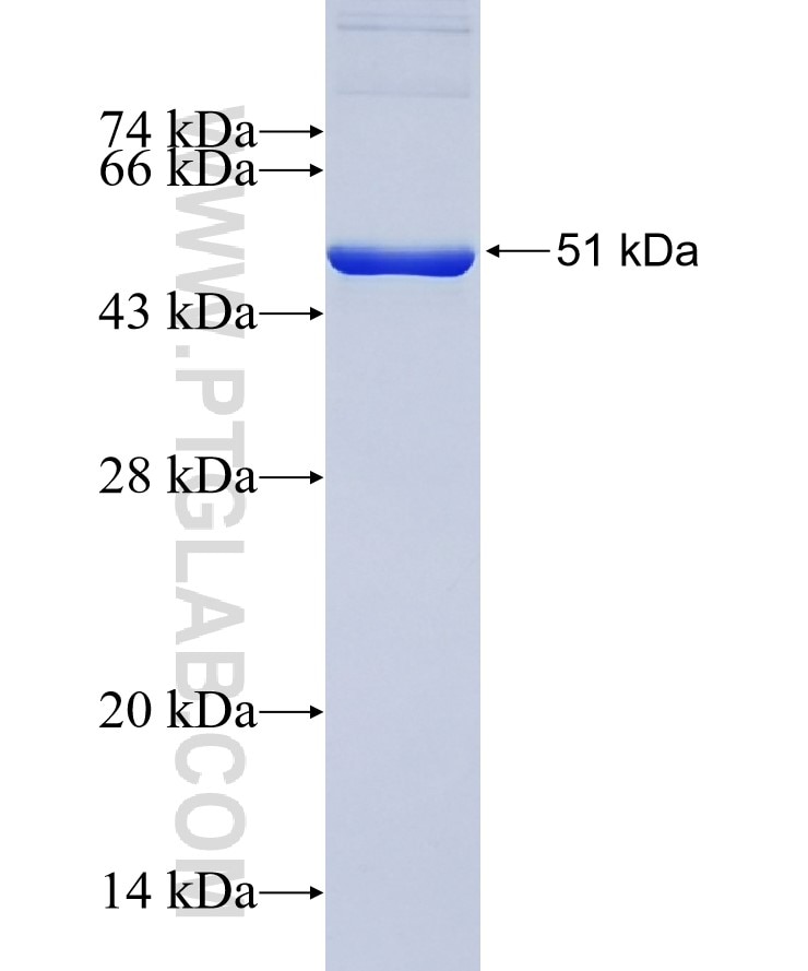ENO1 fusion protein Ag17518 SDS-PAGE