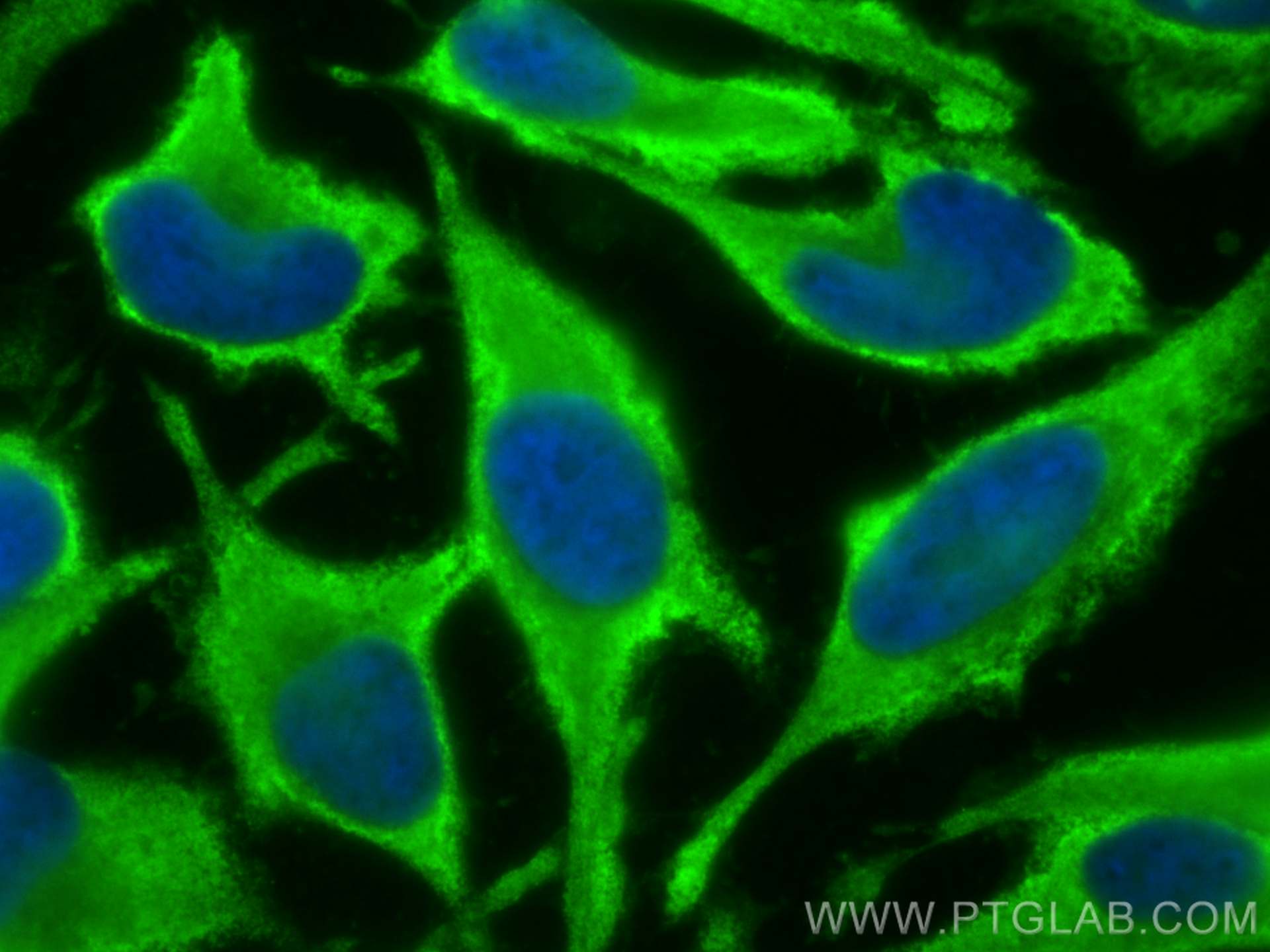 Immunofluorescence (IF) / fluorescent staining of HeLa cells using NSE Polyclonal antibody (10149-1-AP)