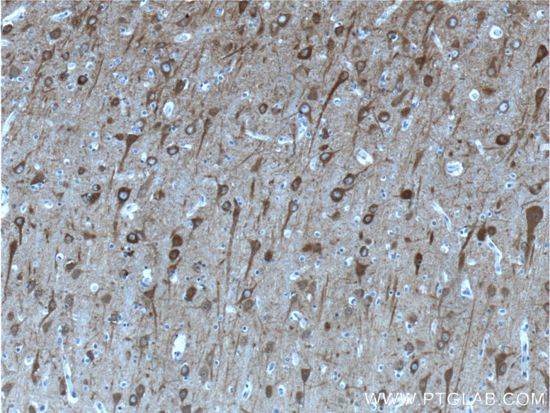 Immunohistochemistry (IHC) staining of human brain tissue using NSE Polyclonal antibody (10149-1-AP)