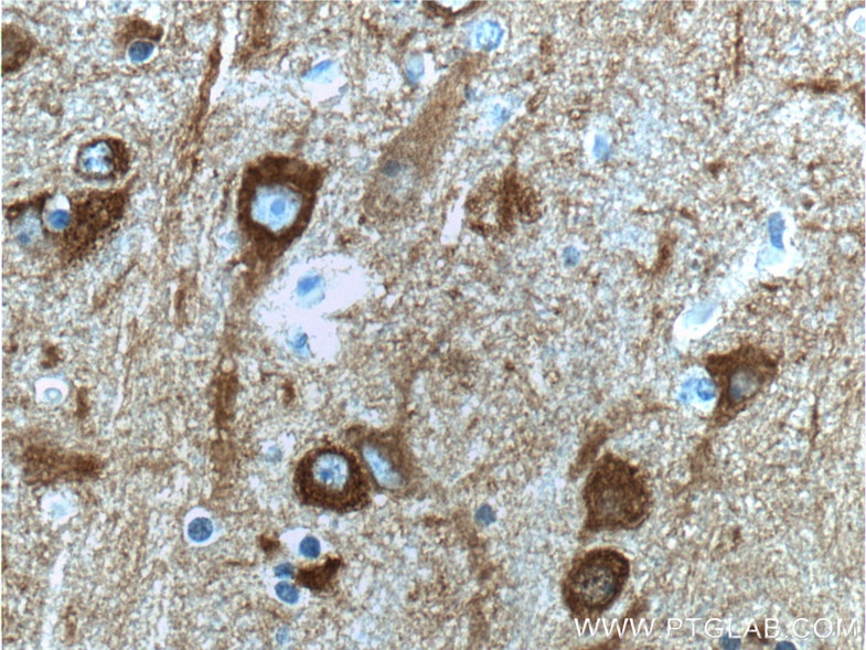Immunohistochemistry (IHC) staining of human brain tissue using NSE Polyclonal antibody (10149-1-AP)