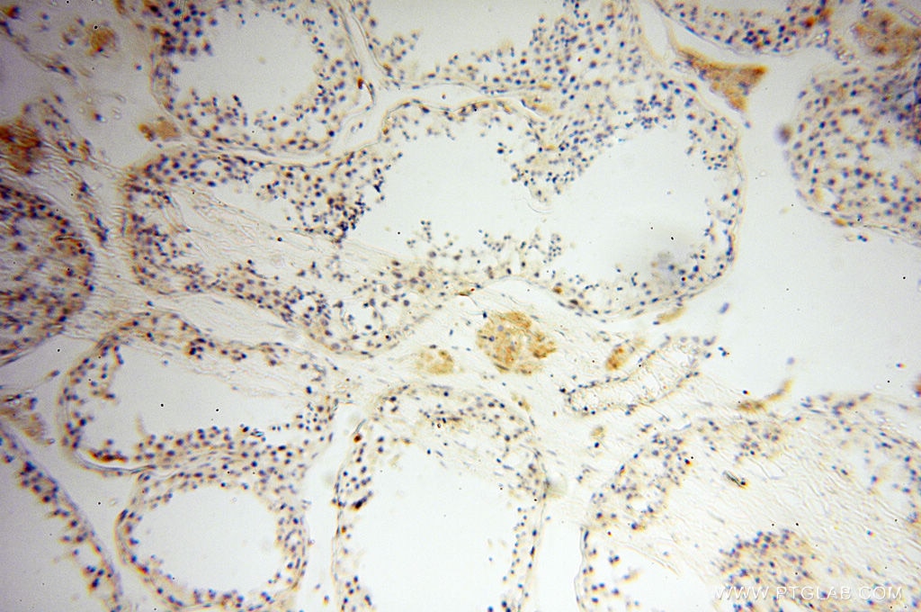 Immunohistochemistry (IHC) staining of human testis tissue using NSE Polyclonal antibody (10149-1-AP)