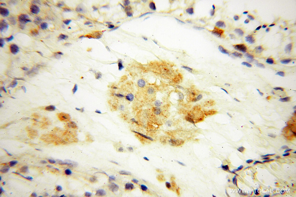 IHC staining of human testis using 10149-1-AP