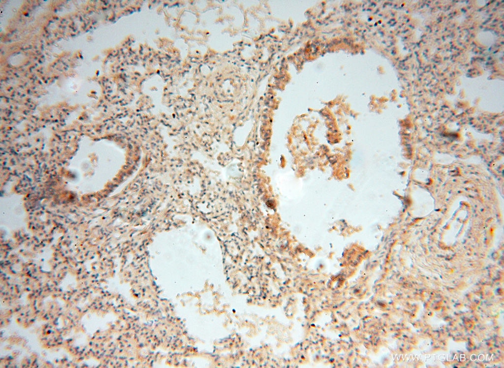 IHC staining of human lung using 10149-1-AP