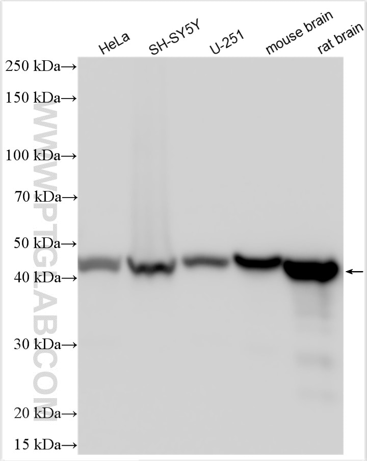 Western Blot (WB) analysis of various lysates using NSE Polyclonal antibody (10149-1-AP)