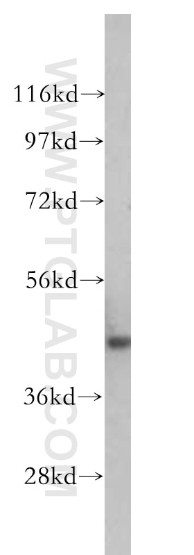 Western Blot (WB) analysis of mouse brain tissue using NSE Polyclonal antibody (10149-1-AP)