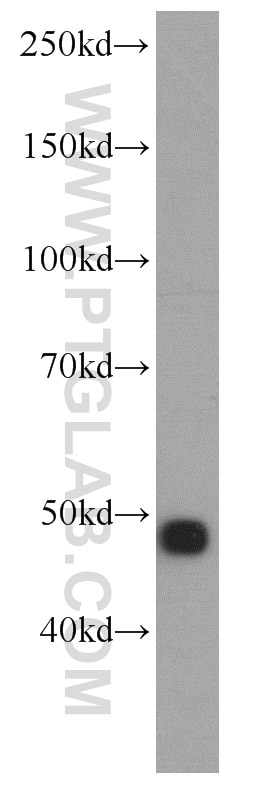 Western Blot (WB) analysis of human brain tissue using NSE Polyclonal antibody (10149-1-AP)