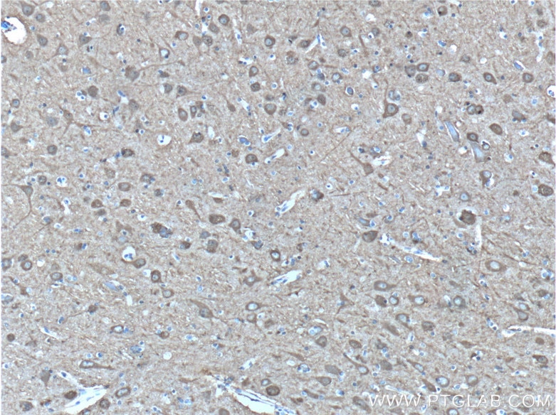 Immunohistochemistry (IHC) staining of human brain tissue using NSE/ENO2-specific Polyclonal antibody (55235-1-AP)