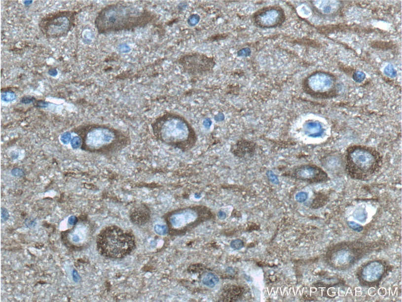 Immunohistochemistry (IHC) staining of human brain tissue using NSE/ENO2-specific Polyclonal antibody (55235-1-AP)