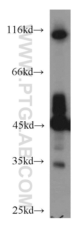 NSE/ENO2-specific