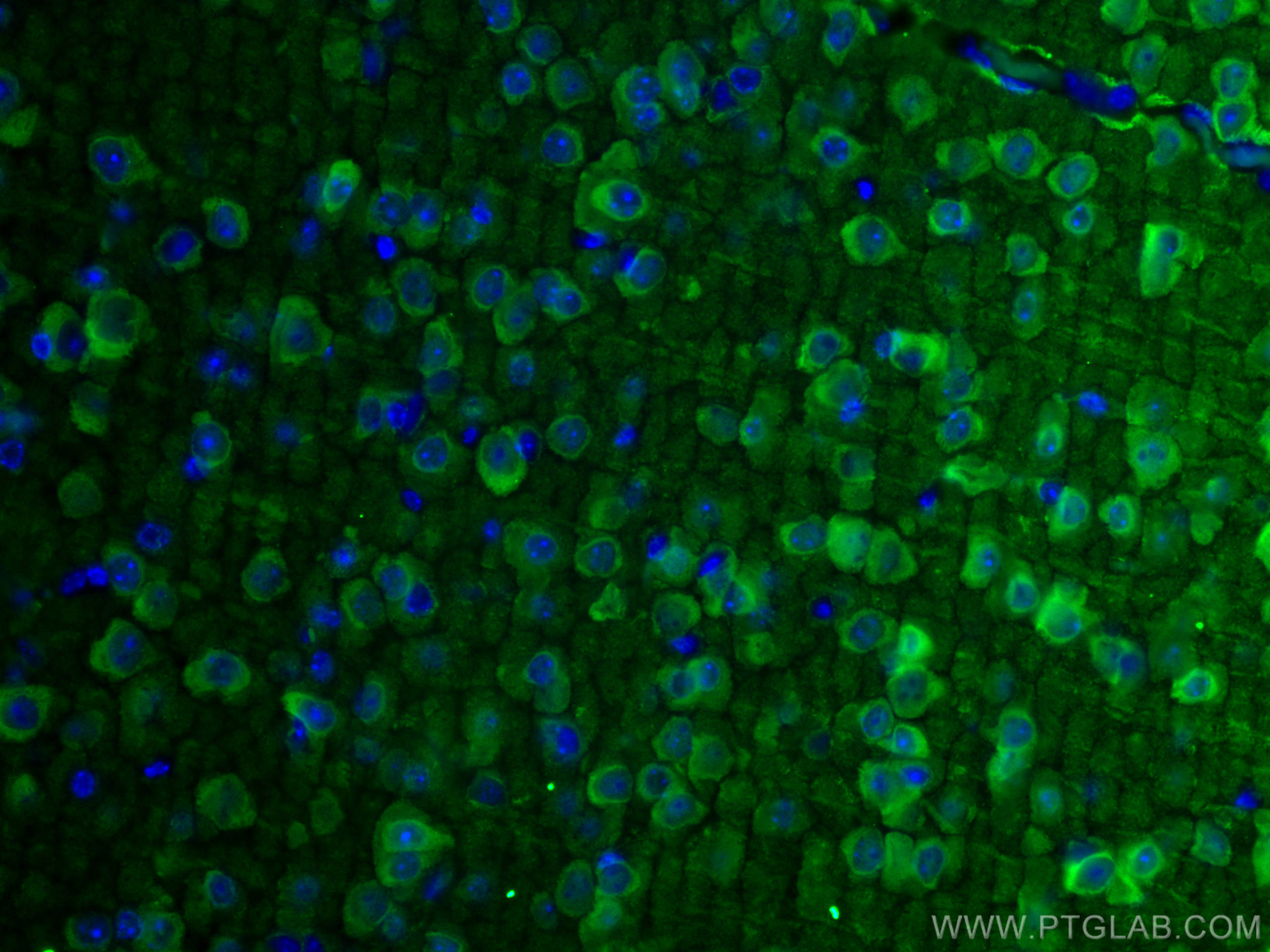 Immunofluorescence (IF) / fluorescent staining of mouse brain tissue using NSE Monoclonal antibody (66150-1-Ig)