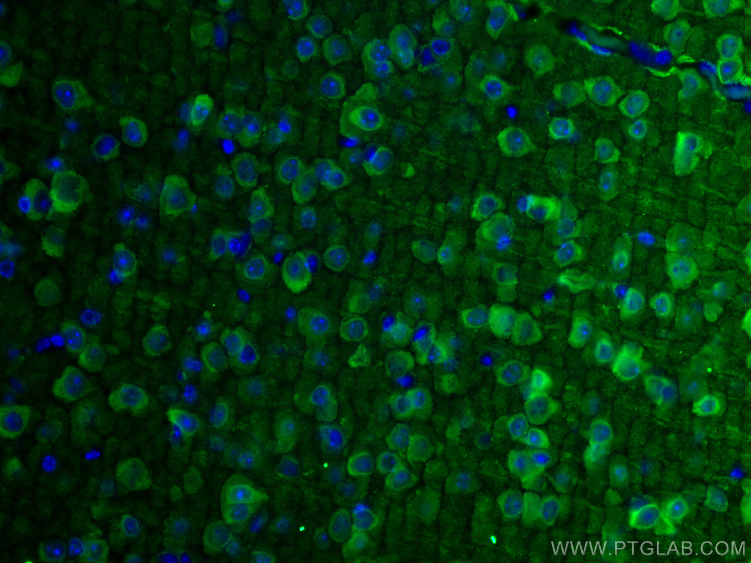 IF Staining of mouse brain using 66150-1-Ig