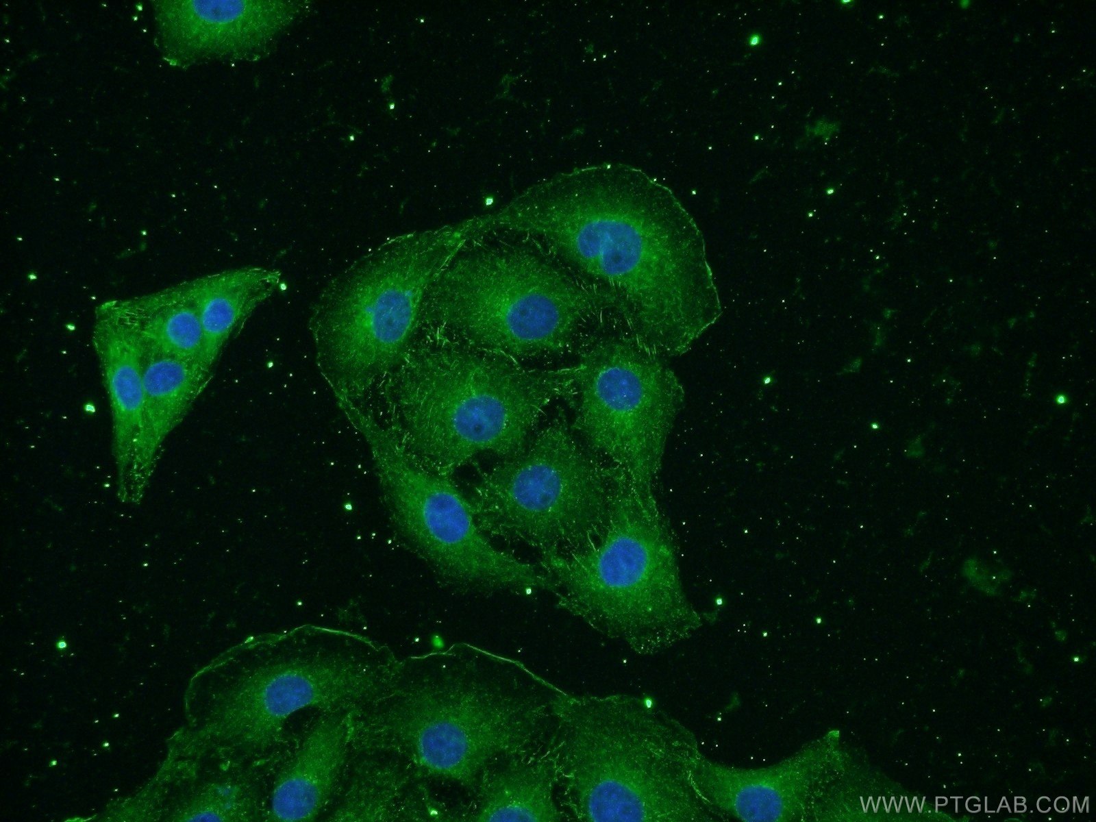 NSE Monoclonal antibody