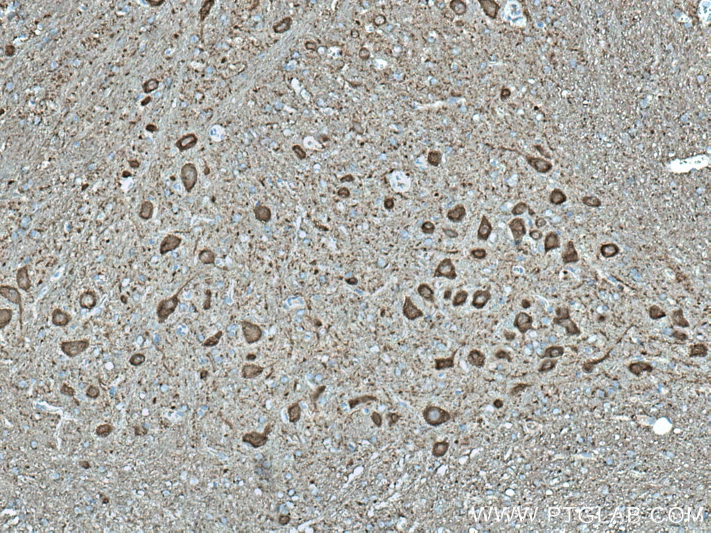 Immunohistochemistry (IHC) staining of rat cerebellum tissue using NSE Monoclonal antibody (66150-1-Ig)