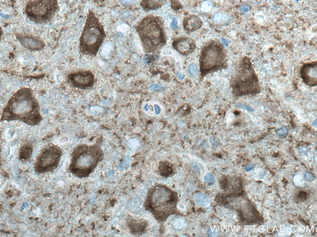 Immunohistochemistry (IHC) staining of rat cerebellum tissue using NSE Monoclonal antibody (66150-1-Ig)