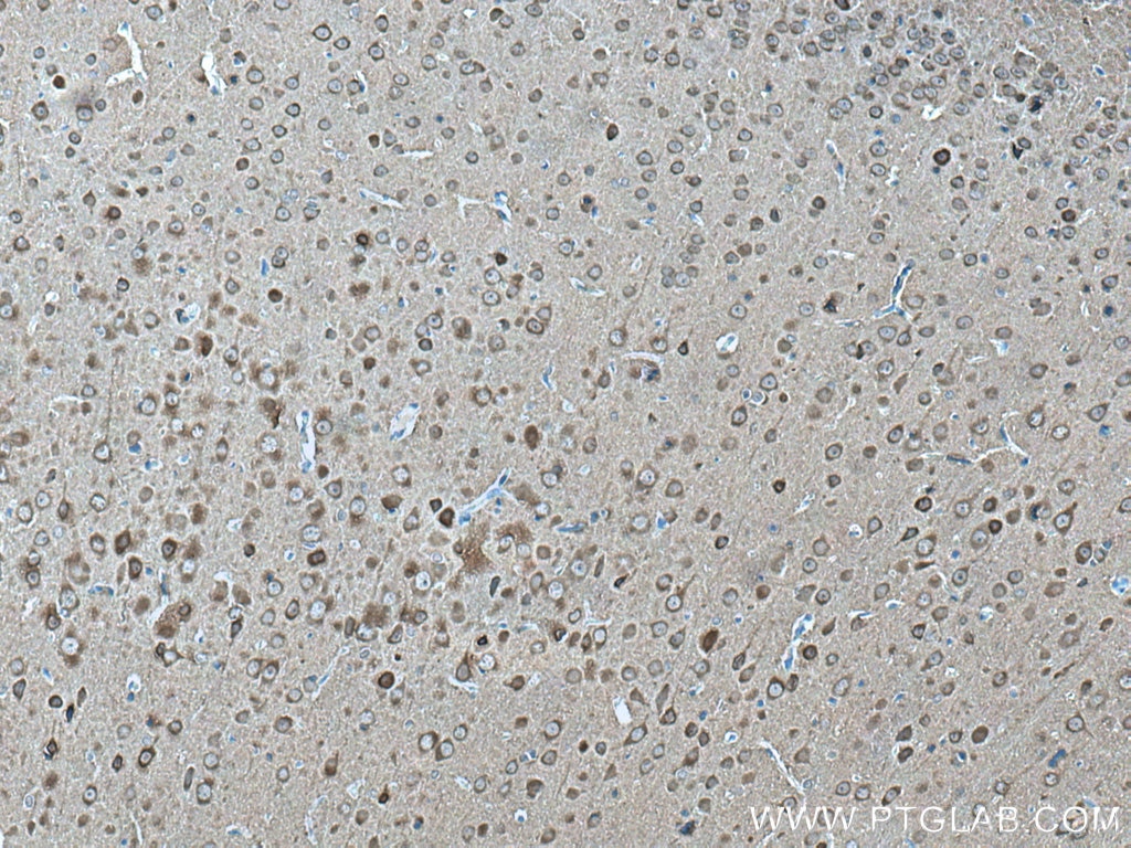 Immunohistochemistry (IHC) staining of rat brain tissue using NSE Monoclonal antibody (66150-1-Ig)