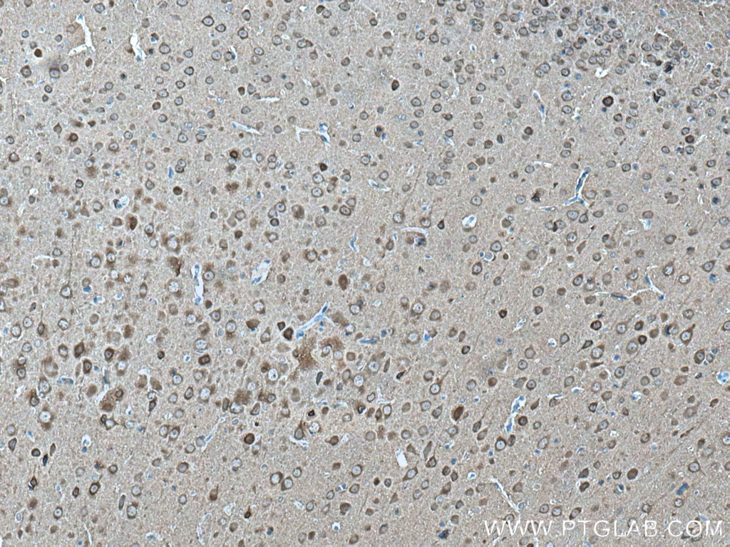 IHC staining of rat brain using 66150-1-Ig