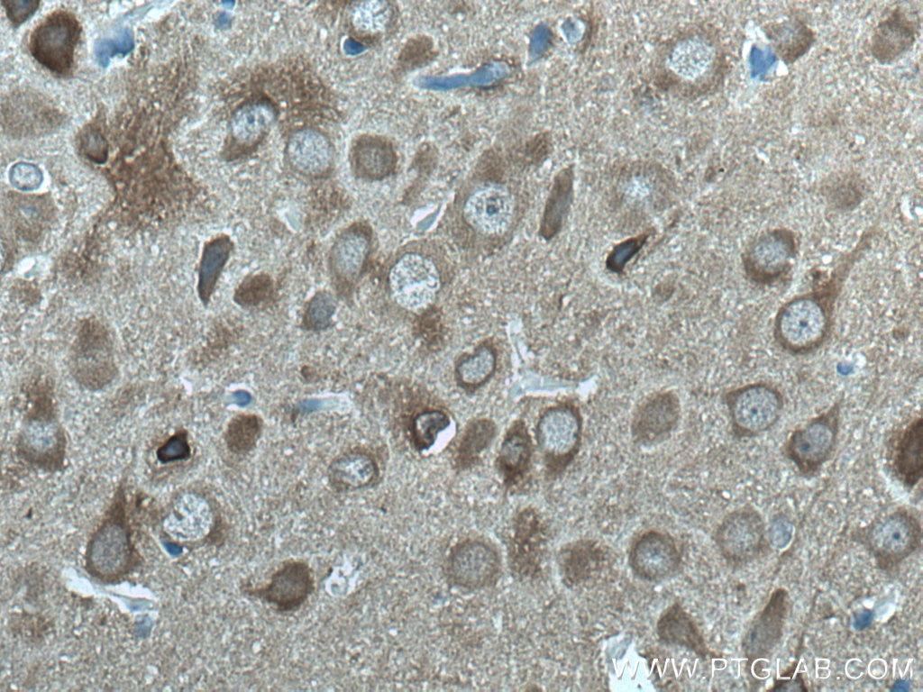 IHC staining of rat brain using 66150-1-Ig