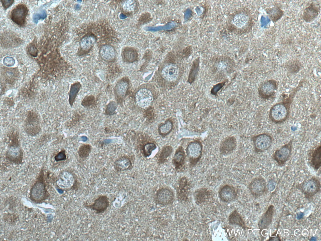 Immunohistochemistry (IHC) staining of rat brain tissue using NSE Monoclonal antibody (66150-1-Ig)