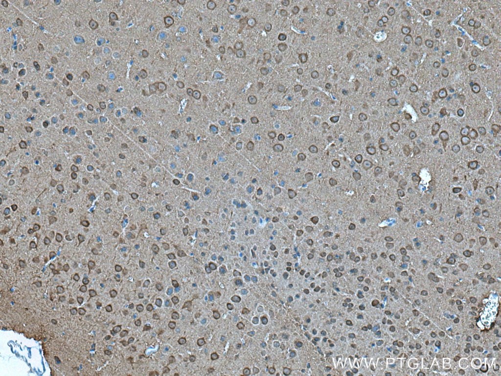 Immunohistochemistry (IHC) staining of mouse brain tissue using NSE Monoclonal antibody (66150-1-Ig)
