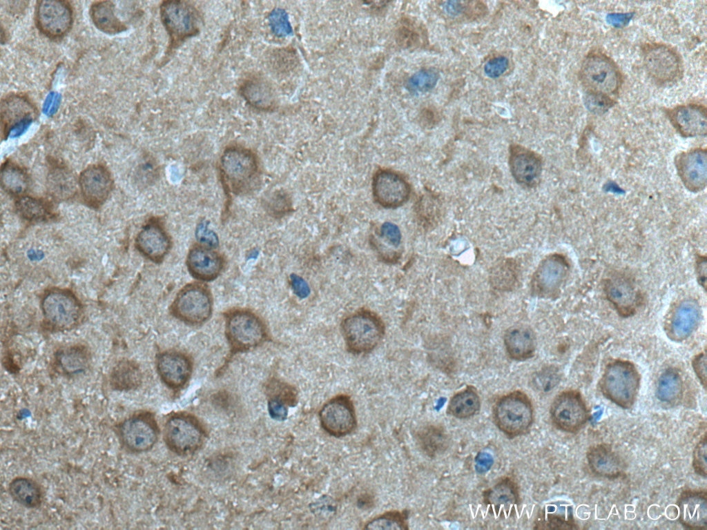 Immunohistochemistry (IHC) staining of mouse brain tissue using NSE Monoclonal antibody (66150-1-Ig)