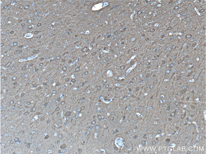 IHC staining of human brain using 66150-1-Ig