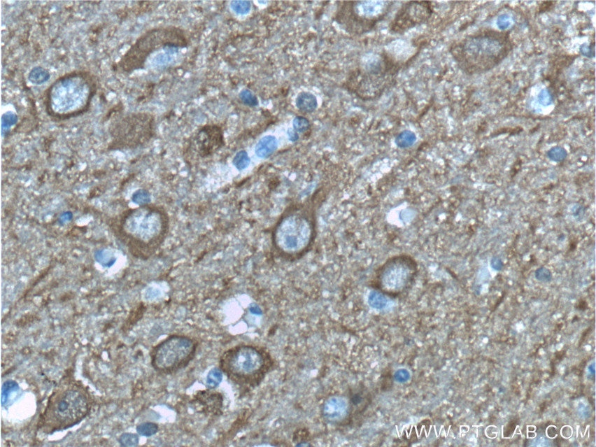 Immunohistochemistry (IHC) staining of human brain tissue using NSE Monoclonal antibody (66150-1-Ig)