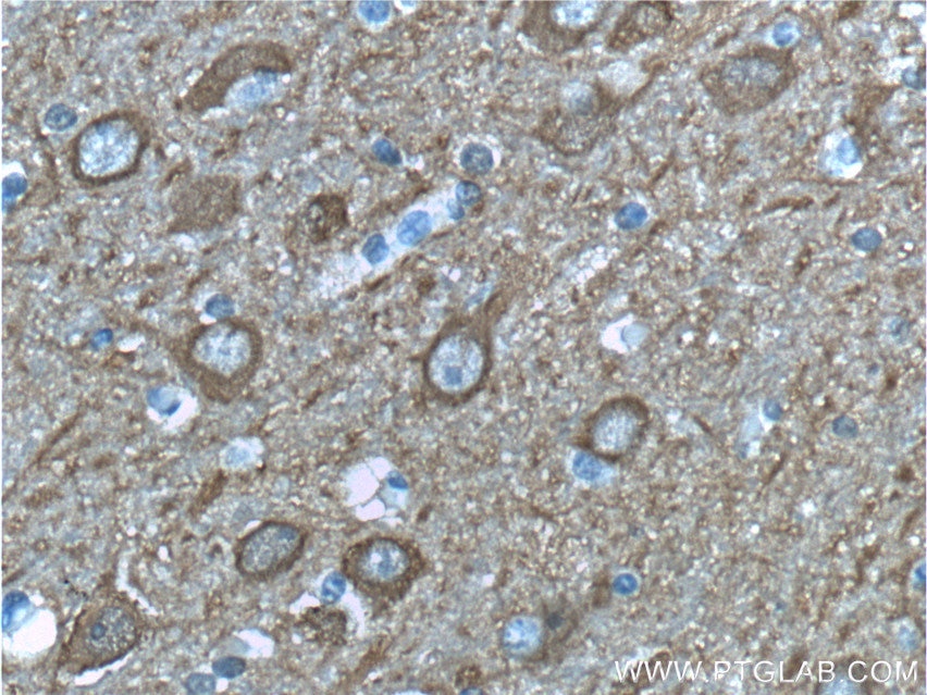 IHC staining of human brain using 66150-1-Ig