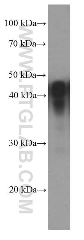 Western Blot (WB) analysis of fetal human brain tissue using NSE Monoclonal antibody (66150-1-Ig)