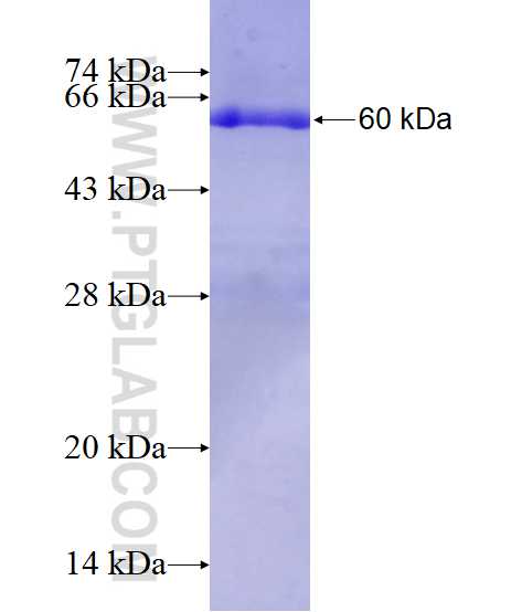 ENO2 fusion protein Ag0196 SDS-PAGE