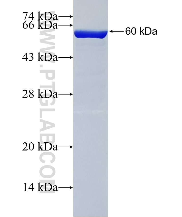 ENO2 fusion protein Ag0196 SDS-PAGE