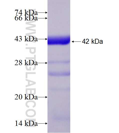 ENO2 fusion protein Ag19106 SDS-PAGE