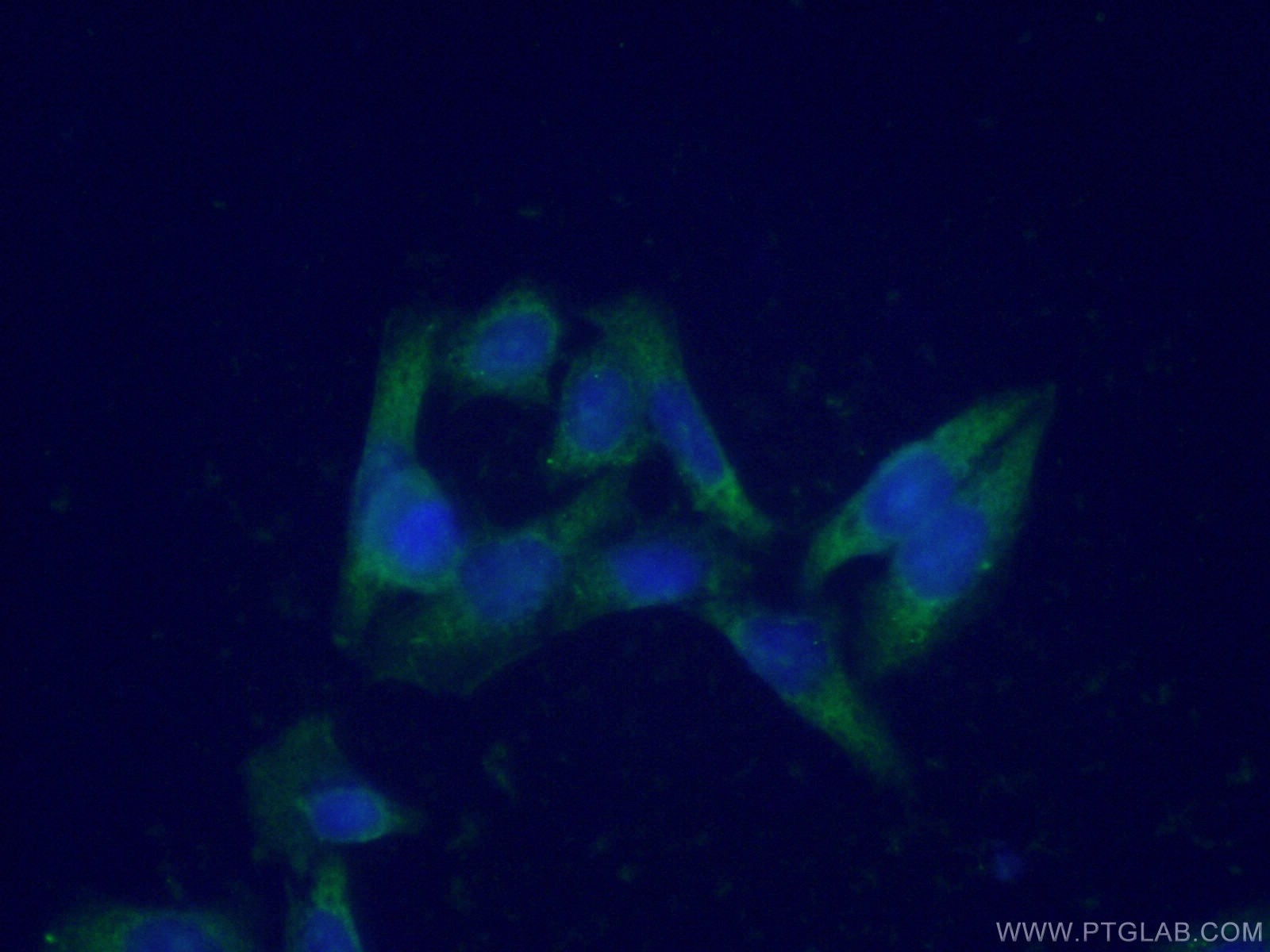 Immunofluorescence (IF) / fluorescent staining of HeLa cells using ENO3 Polyclonal antibody (16421-1-AP)