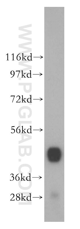 Western Blot (WB) analysis of human skeletal muscle tissue using ENO3 Polyclonal antibody (16421-1-AP)