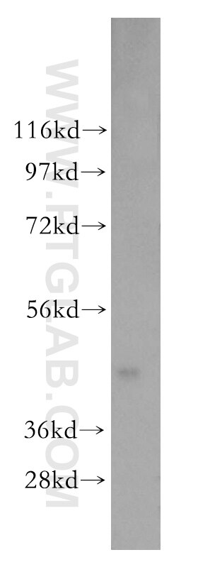 Western Blot (WB) analysis of human brain tissue using ENO3 Polyclonal antibody (16421-1-AP)