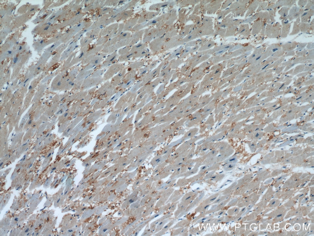 Immunohistochemistry (IHC) staining of human heart tissue using ENO3-specific Polyclonal antibody (55234-1-AP)