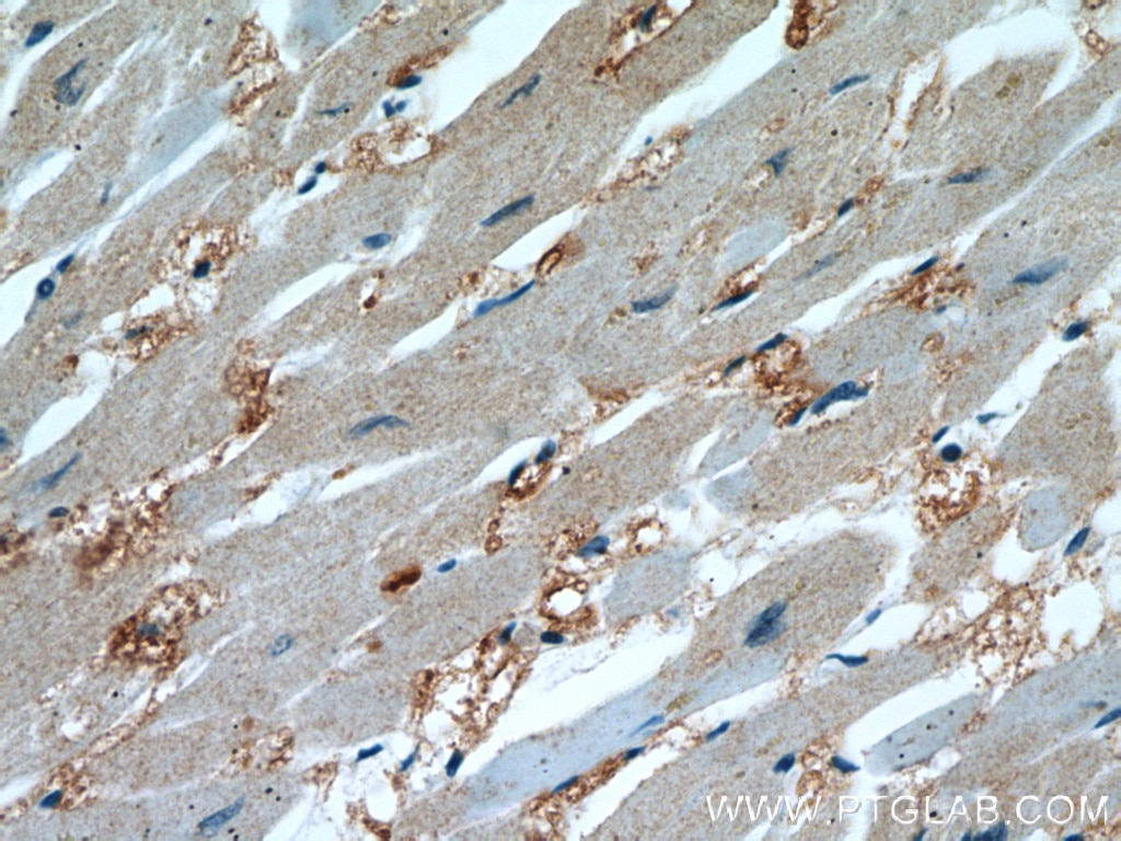 Immunohistochemistry (IHC) staining of human heart tissue using ENO3-specific Polyclonal antibody (55234-1-AP)