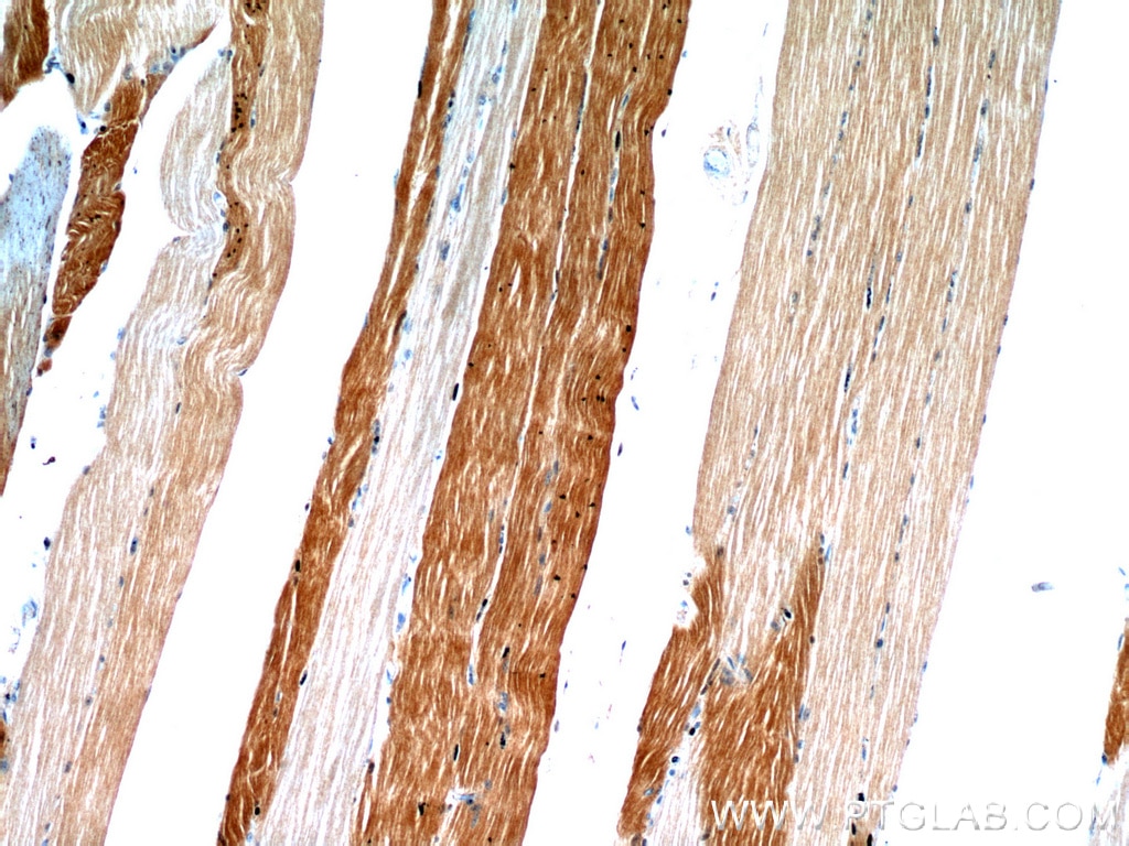 Immunohistochemistry (IHC) staining of human skeletal muscle tissue using ENO3-specific Polyclonal antibody (55234-1-AP)