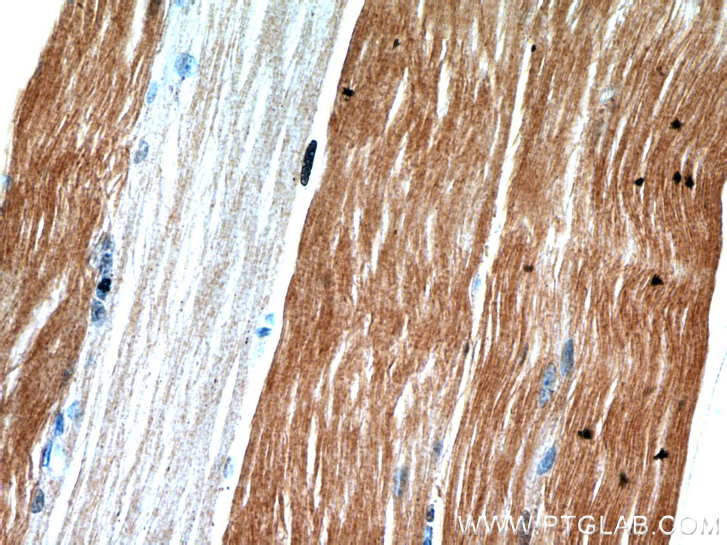 Immunohistochemistry (IHC) staining of human skeletal muscle tissue using ENO3-specific Polyclonal antibody (55234-1-AP)