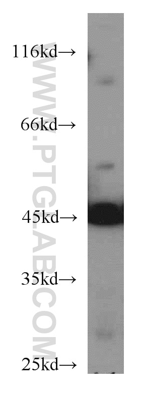 Western Blot (WB) analysis of mouse brain tissue using ENO3-specific Polyclonal antibody (55234-1-AP)